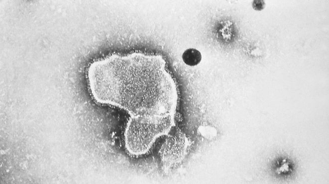 This 1981 photo provided by the Centers for Disease Control and Prevention (CDC) shows an electron micrograph of Respiratory Syncytial Virus, also known as RSV. Children's hospitals in parts of the country are seeing a distressing surge in RSV, a common respiratory illness that can cause severe breathing problems for babies. Cases fell dramatically two years ago as the pandemic shut down schools, day cares and businesses. Then, with restrictions easing, the summer of 2021 brought an alarming increase in what is normally a fall and winter virus. (CDC via AP)